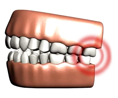 Jaw pain is something that Franklin, TN patients can have treated by TMJ dentist Dr. Poss in Brentwood and Murfreesboro.