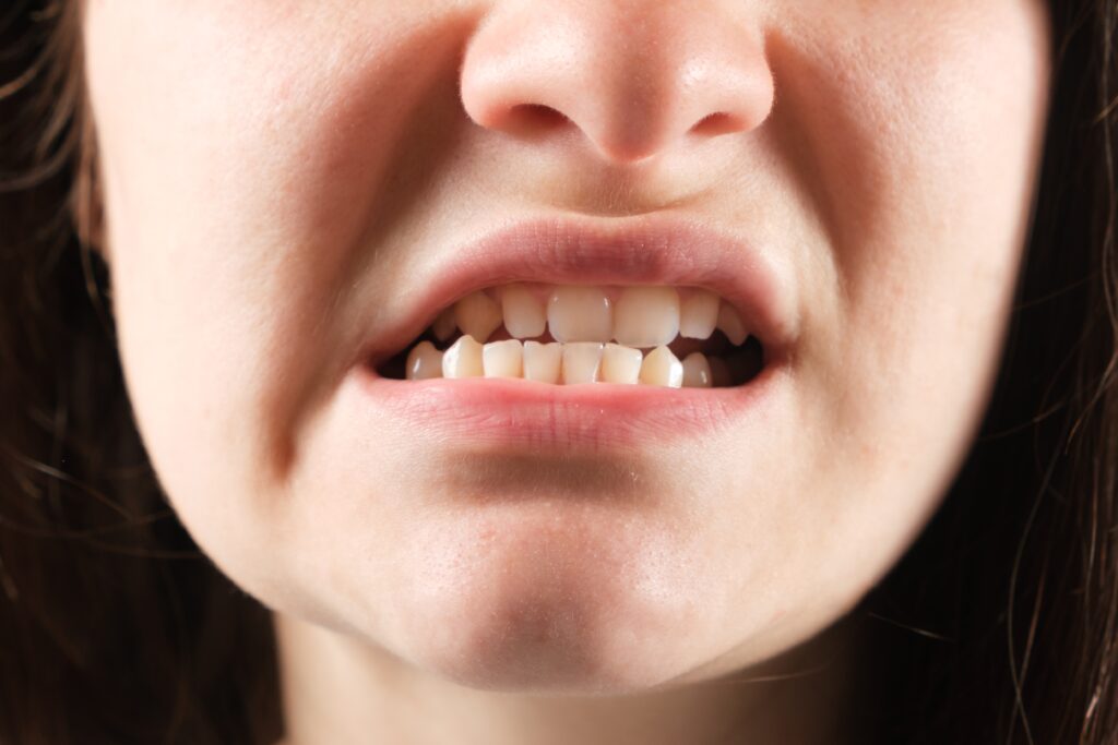 shutterstock 2152624327