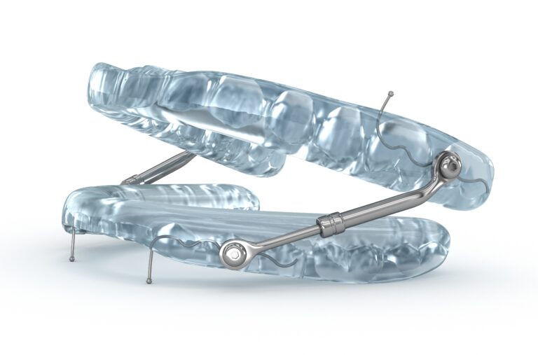 oral appliance device used at Sleep Apnea & TMJ Solutions