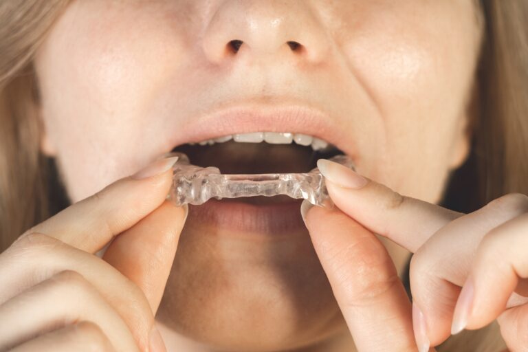 woman putting in a mouth guard, TMJ treatment